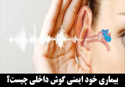 بیماری خود ایمنی گوش داخلی یا اتوایمیون چیست؟