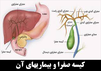 کیسه صفرا (Gallbladder) و بیماریهای آن
